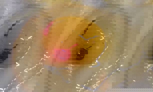 blood spots in the egg